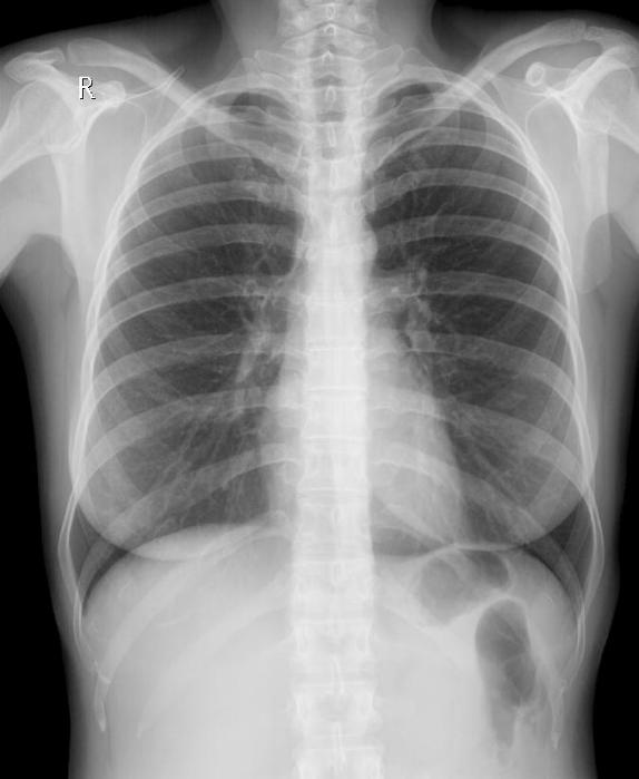 Ακτινολόγος Νότια προάστια Ακτινολόγοι Παλαιό Φάληρο