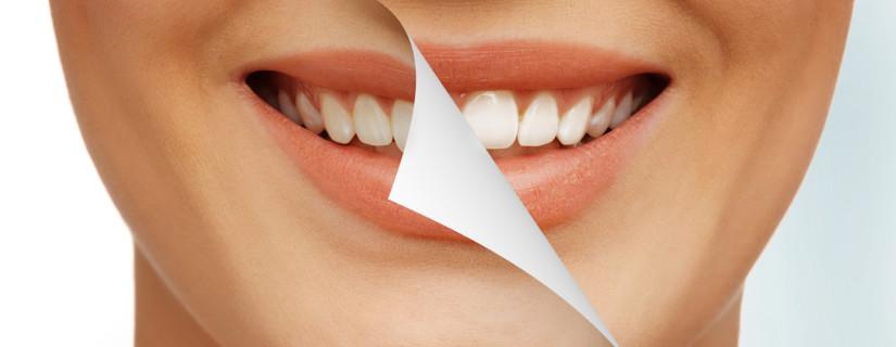 Αισθητική οδοντιατρική Δυτικά Προάστια, Ορθοδοντικός Αιγάλεω, Ορθοδοντικοί Αιγάλεω