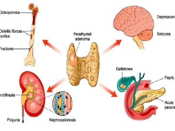 Αντιμετώπιση ορμονικών διαταραχών Ελευσίνα, Αντιμετώπιση θυρεοειδούς Ελευσίνα, Διαβητολόγος Μάνδρα