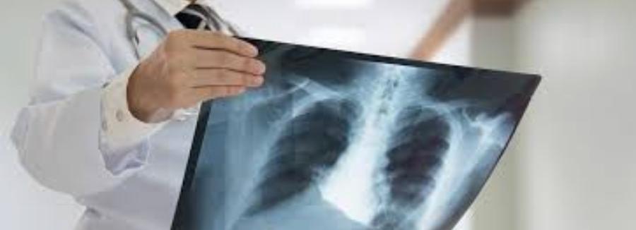 Πνευμονολόγος Παγκράτι, Πνευμονολόγοι Παγκράτοι, Φυματιολόγοι Παγκράτι, λοιμώξεις αναπνευστικού Παγκράτι