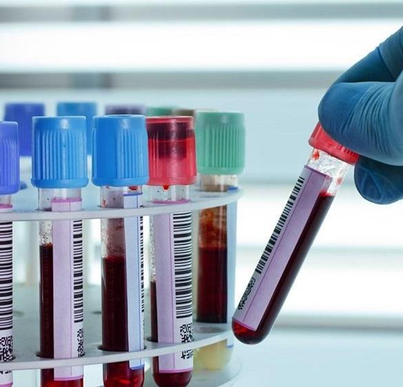 Μικροβιολόγοι Νέα Ιωνία αιμοληψία κατ'οίκον Νέα Ιωνία , μικροβιολογικό εργαστήριο Νέα Ιωνία, εξετάσεις ούρων, αιμοληψίες κατ'οίκον Καλογρέζα, Αλσούπολη, Πευκάκια