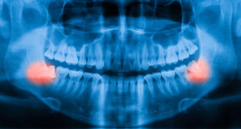 Dental Group, Οδοντίατροι - Ορθοδοντικοί Βόλος