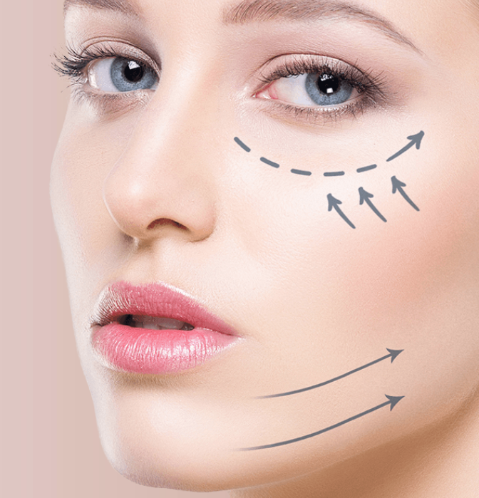 Κυρμίζογλου