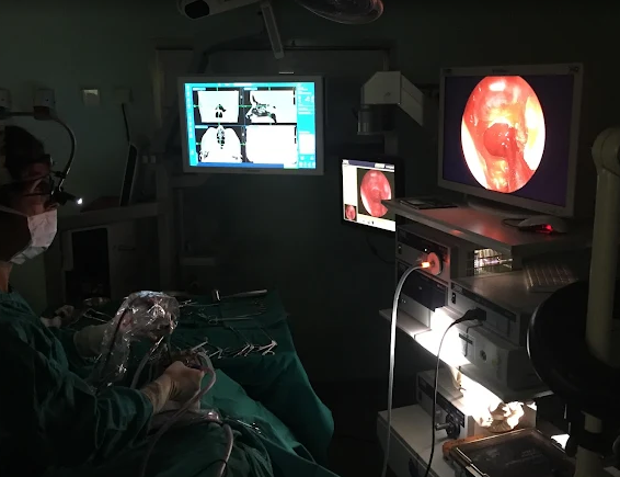 ΩΤΟΡΙΝΟΛΑΡΥΓΓΟΛΟΓΟΙ ΜΟΣΧΑΤΟ, ΩΡΛ ΜΟΣΧΑΤΟ, ΩΤΟΡΙΝΟΛΑΡΥΓΓΟΛΟΓΟΣ ΜΟΣΧΑΤΟ