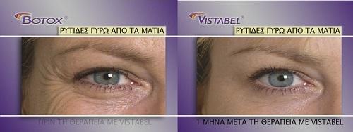 ΔΕΡΜΑΤΟΛΟΓΟΙ ΒΟΥΛΑ, ΑΦΡΟΔΙΣΙΟΛΟΓΟΙ ΒΑΡΚΙΖΑ: Laser Science, Δερματολόγος Αφροδισιολόγος εξυπηρετεί Βάρκιζα, Βούλα