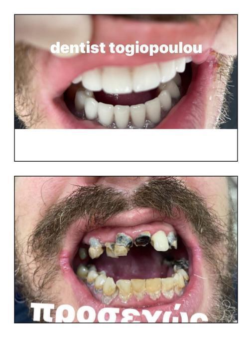 ΟΔΟΝΤΙΑΤΡΟΙ ΚΑΜΑΤΕΡΟ: Η οδοντίατρος Dr. Καλλιόπη Τογιοπούλου εξυπηρετεί Καματερό και γύρω περιοχές.